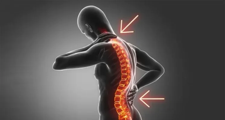 گودی کمر (لوردوز کمر )