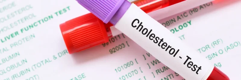 راهکارهای کنترل کلسترول چیست؟