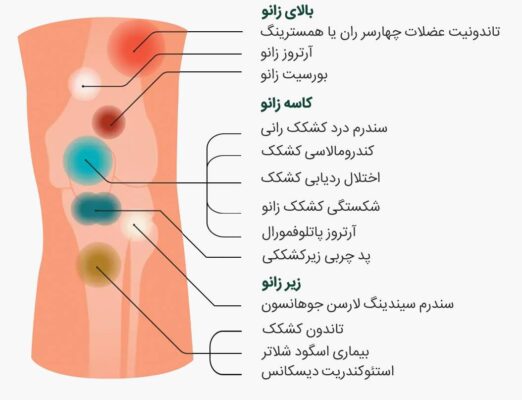 چه ورزشی برای زانو درد خوب است ؟