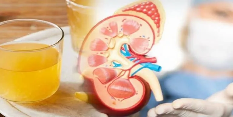 درمانهای گیاهی ناراحتی های کلیه