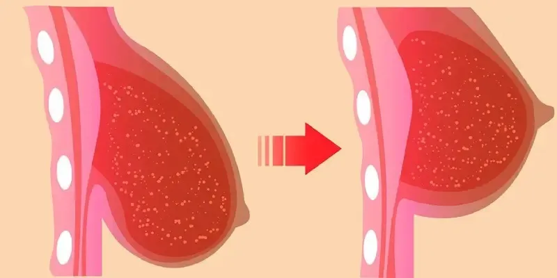 پنج راه آسان برای سفت شدن سینه‌ ها در عرض یک ماه برای بانوان